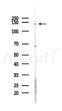 BMS1 Antibody - Western blot analysis of lysates from HUVEC cells(heat-shock 45min treatment), using BMS1 Antibody at 1/1000 dilution.