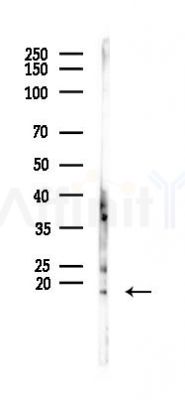 CCL26 Antibody - Western blot analysis of lysates from Hela cells(starvation 24h treatment), using CCL26 Antibody at 1/1000 dilution.