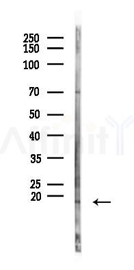 CCL27 Antibody - Western blot analysis of lysates from Hela cells(starvation 24h treatment), using CCL27 Antibody at 1/1000 dilution.