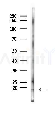 CCL27 Antibody - Western blot analysis of lysates from A2780 cells(starvation 24h treatment), using CCL27 Antibody at 1/1000 dilution.