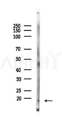 CCL27 Antibody - Western blot analysis of lysates from Rat lung, using CCL27 Antibody at 1/1000 dilution.