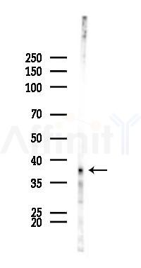 TCF19 Antibody - Western blot analysis of lysates from B16F10-LUC cells(UV 30min treatment), using TCF19 Antibody at 1/1000 dilution.