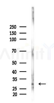 TNNT1 Antibody - Western blot analysis of lysates from Mouse liver, using TNNT1 Antibody at 1/1000 dilution.