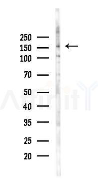 MED14 Antibody - Western blot analysis of lysates from 293 cells(UV 30min treatment), using MED14 Antibody at 1/1000 dilution.