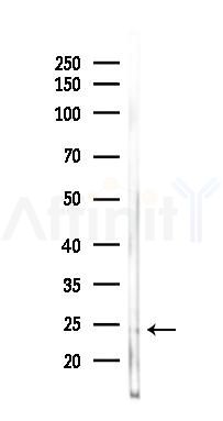 LDOC1L Antibody - Western blot analysis of lysates from Rat muscle, using LDOC1L Antibody at 1/1000 dilution.