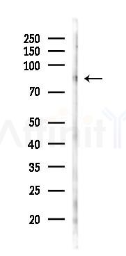 hnRNP M Antibody - Western blot analysis of lysates from Mouse testis, using hnRNP M Antibody at 1/1000 dilution.