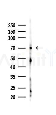 DLEC1 Antibody - Western blot analysis of lysates from 293 cells(UV 30min treatment), using DLEC1 Antibody at 1/1000 dilution.