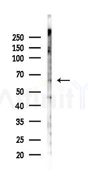 TAF6L Antibody - Western blot analysis of lysates from 293 cells(UV 30min treatment), using TAF6L Antibody at 1/1000 dilution.