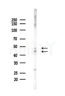 Phospho-GSK3 beta (Ser9) Antibody - Western blot analysis of lysates from 293 cells(heat-shock 45min treatment), using Phospho-GSK3 beta (Ser9) Antibody at 1/1000 dilution.