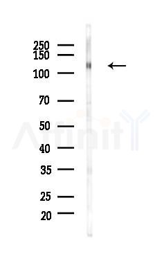 Phospho-CBL (Tyr700) Antibody - Western blot analysis of lysates from HUVEC cells(UV 30min treatment), using Phospho-CBL (Tyr700) Antibody at 1/1000 dilution.