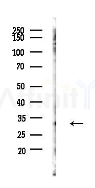 Phospho-DARPP32 (Ser97)[Ser102] Antibody - Western blot analysis of lysates from PC12 cells(UV 30min treatment), using Phospho-DARPP32 (Ser97)[Ser102] Antibody at 1/1000 dilution.