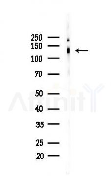 Phospho-TIE2 (Tyr992) Antibody - Western blot analysis of lysates from HUVEC cells(UV 30min treatment), using Phospho-TIE2 (Tyr992) Antibody at 1/1000 dilution.