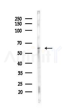 Phospho-Lck (Tyr505) Antibody - Western blot analysis of lysates from Mouse heart, using Phospho-Lck (Tyr505) Antibody at 1/1000 dilution.