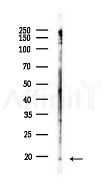 Phospho-Histone H2A (Thr121) Antibody - Western blot analysis of lysates from COLO205 cells(heat-shock 45min treatment), using Phospho-Histone H2A (Thr121) Antibody at 1/1000 dilution.