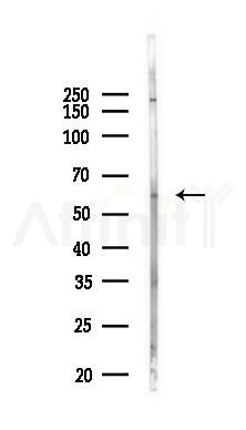 Phospho-ATF2 (Ser62/Ser44) Antibody - Western blot analysis of lysates from COLO205 cells(heat-shock 45min treatment), using Phospho-ATF2 (Ser62/Ser44) Antibody at 1/1000 dilution.