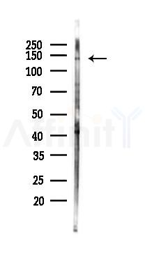 Phospho-eNOS (Ser1177) Antibody - Western blot analysis of lysates from Rat brain, using Phospho-eNOS (Ser1177) Antibody at 1/1000 dilution.