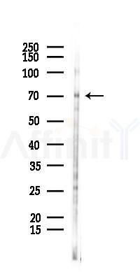 Phospho-eNOS (Ser1177) Antibody - Western blot analysis of lysates from HUVEC cells(UV 30min treatment), using Phospho-eNOS (Ser1177) Antibody at 1/1000 dilution.