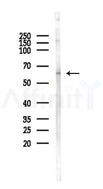 Phospho-Smad3 (Ser425) Antibody - Western blot analysis of lysates from Mouse testis, using Phospho-Smad3 (Ser425) Antibody at 1/1000 dilution.
