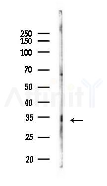 Phospho-CDK5 (Tyr15) Antibody - Western blot analysis of lysates from COLO205 cells(heat-shock 45min treatment), using Phospho-CDK5 (Tyr15) Antibody at 1/1000 dilution.
