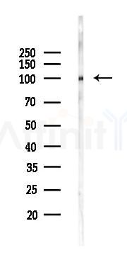Phospho-alpha 1 Catenin (Ser655/Thr658) Antibody - Western blot analysis of lysates from Mouse heart, using Phospho-alpha 1 Catenin (Ser655/Thr658) Antibody at 1/1000 dilution.