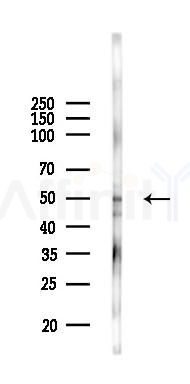 Phospho-ZIP7 (Ser275/Ser276) Antibody - Western blot analysis of lysates from Hela cells(LPS 4h treatment), using Phospho-ZIP7 (Ser275/Ser276) Antibody at 1/1000 dilution.