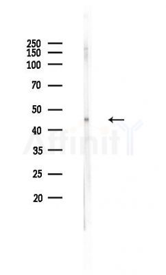 Phospho-p38 MAPK (Thr180/Tyr182) Antibody - Western blot analysis of lysates from PC12 cells(heat-shock 45min treatment), using Phospho-p38 MAPK (Thr180/Tyr182) Antibody at 1/1000 dilution.