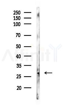 Phospho-PPP1R8/ARD1 (Ser199) Antibody - Western blot analysis of lysates from Mouse heart, using Phospho-PPP1R8/ARD1 (Ser199) Antibody at 1/1000 dilution.