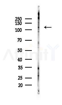 RapGEF1 Antibody - Western blot analysis of lysates from PC12 cells(UV 30min treatment), using RapGEF1 Antibody at 1/1000 dilution.