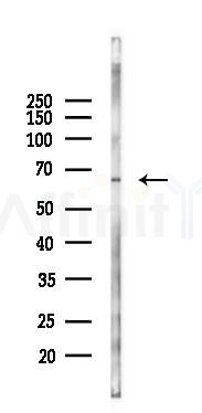 NF-kB p65 Antibody - Western blot analysis of lysates from Hela cells(heat-shock 45min treatment), using NF-kB p65 Antibody at 1/1000 dilution.