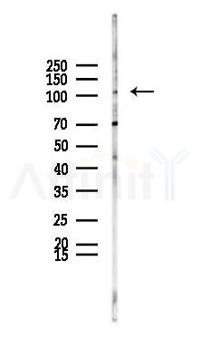 PI3 kinase P110 alpha Antibody - Western blot analysis of lysates from K562 cells(heat-shock 45min treatment), using PI3 kinase P110 alpha Antibody at 1/1000 dilution.