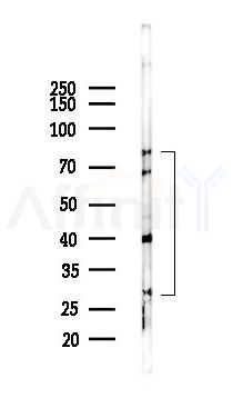 CD63 Antibody - Western blot analysis of lysates from K562 cells(UV 30min treatment), using CD63 Antibody at 1/1000 dilution.