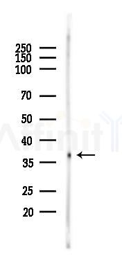 CD8 Antibody - Western blot analysis of lysates from Rat brain, using CD8 Antibody at 1/1000 dilution.
