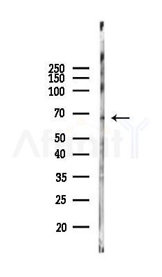MMP9 Antibody - Western blot analysis of lysates from Rat brain, using MMP9 Antibody at 1/1000 dilution.