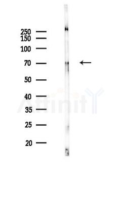 MMP9 Antibody - Western blot analysis of lysates from K562 cells(UV 30min treatment), using MMP9 Antibody at 1/1000 dilution.
