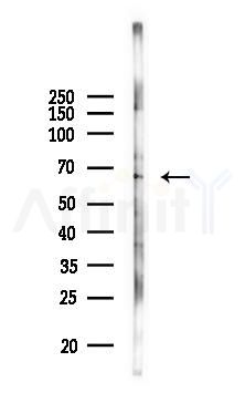 MMP9 Antibody - Western blot analysis of lysates from Rat brain, using MMP9 Antibody at 1/1000 dilution.