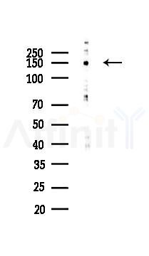 N Cadherin Antibody - Western blot analysis of lysates from HUVEC cells(UV 30min treatment), using N Cadherin Antibody at 1/1000 dilution.