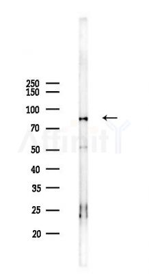 GRP78 Antibody - Western blot analysis of lysates from Hela cells(heat-shock 45min treatment), using GRP78 Antibody at 1/1000 dilution.