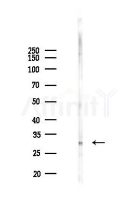 Bcl-2 Antibody - Western blot analysis of lysates from Mouse brain, using Bcl-2 Antibody at 1/1000 dilution.