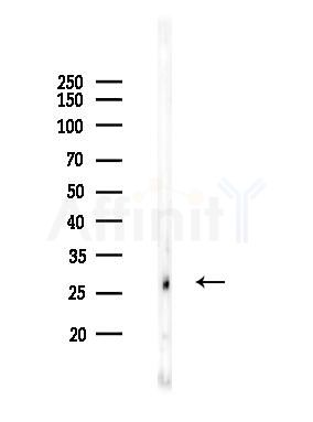 Bcl-2 Antibody - Western blot analysis of lysates from B16F10-LUC cells(starvation 24h treatment), using Bcl-2 Antibody at 1/1000 dilution.