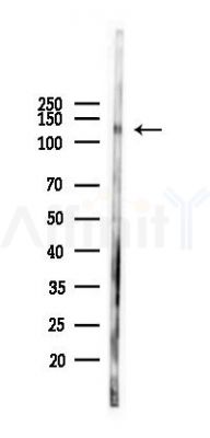 CD31 Antibody - Western blot analysis of lysates from HUVEC cells(UV 30min treatment), using CD31 Antibody at 1/1000 dilution.