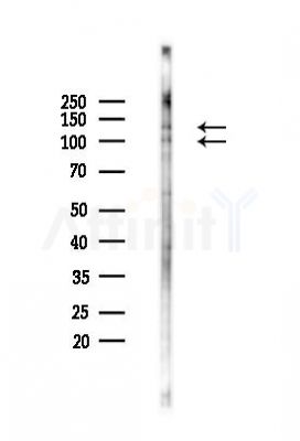CD31 Antibody - Western blot analysis of lysates from K562 cells(UV 30min treatment), using CD31 Antibody at 1/1000 dilution.