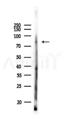 PI3K p85 alpha Antibody - Western blot analysis of lysates from Rat kidney, using PI3K p85 alpha Antibody at 1/1000 dilution.