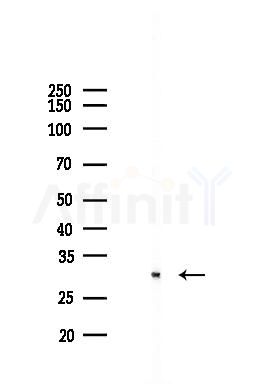 Caspase 3 Antibody - Western blot analysis of lysates from Mouse kidney, using Caspase 3 Antibody at 1/1000 dilution.