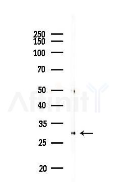 Caspase 3 Antibody - Western blot analysis of lysates from Rat heart, using Caspase 3 Antibody at 1/1000 dilution.