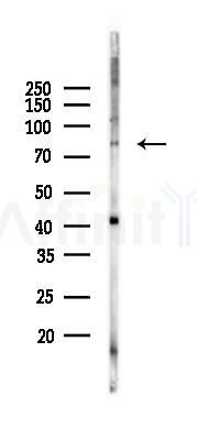 FOXO1A Antibody - Western blot analysis of lysates from Hela cells(heat-shock 45min treatment), using FOXO1A Antibody at 1/1000 dilution.