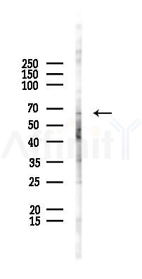 Phospho-PDPK1 (Thr245) Antibody - Western blot analysis of lysates from 293 cells(starvation 24h treatment), using Phospho-PDPK1 (Thr245) Antibody at 1/1000 dilution.