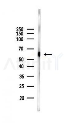 Phospho-RIP3 (Ser232) Antibody - Western blot analysis of lysates from Rat brain, using Phospho-RIP3 (Ser232) Antibody at 1/1000 dilution.
