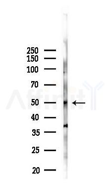 Phospho-RIP3 (Ser232) Antibody - Western blot analysis of lysates from K562 cells(starvation 24h treatment), using Phospho-RIP3 (Ser232) Antibody at 1/1000 dilution.