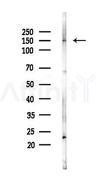 LATS2 Antibody - Western blot analysis of lysates from HUVEC cells(UV 30min treatment), using LATS2 Antibody at 1/1000 dilution.
