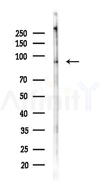 Phospho-Leptin Receptor (Tyr986) Antibody - Western blot analysis of lysates from K562 cells(LPS 4h treatment), using Phospho-Leptin Receptor (Tyr986) Antibody at 1/1000 dilution.
